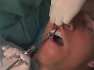 anesthesia in the upper jaw